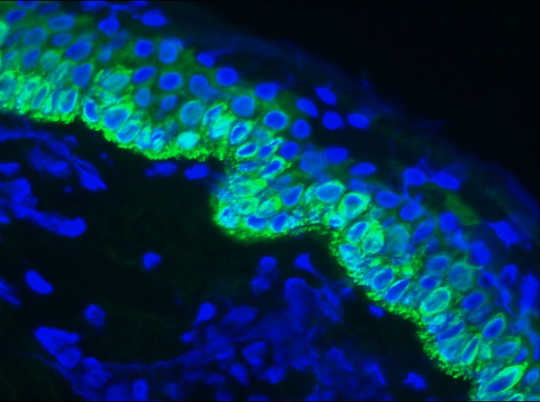 Figure 1. Indirect immunofluorescence staining of swine skin frozen tissue section with MUB0323P (RCK107; Mouse anti keratin 14). Dilution 1:200. Specific staining of the basal and parabasal cells of the epidermis. No reactivity in the connective tissues.